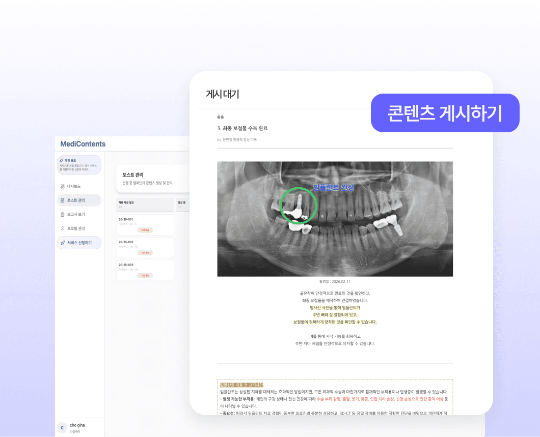 완벽한 원고, 스토리 텔링